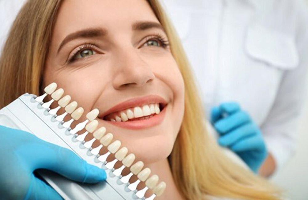 Laminate Veneers Teeth in Turkey